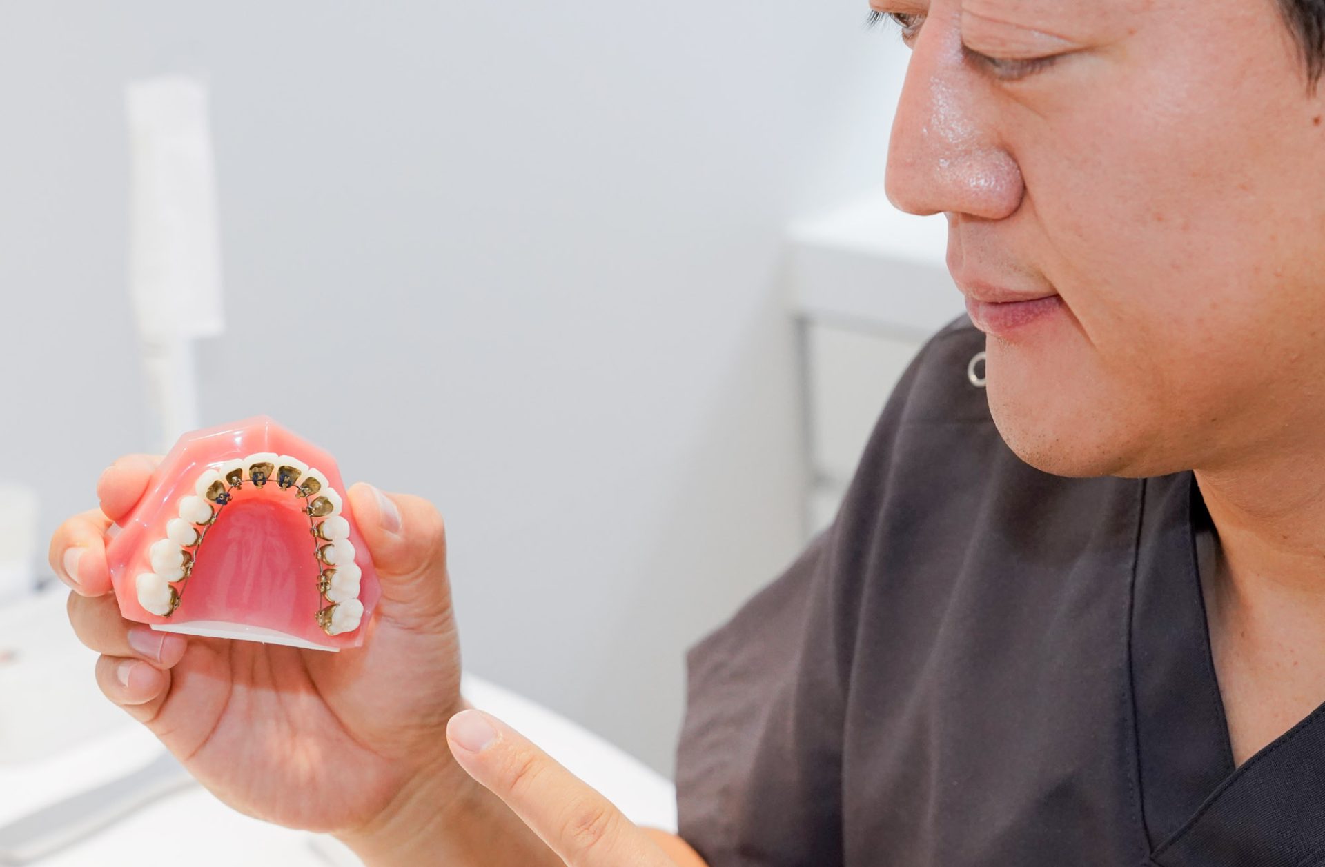 裏側矯正は目立たない歯列矯正の治療方法