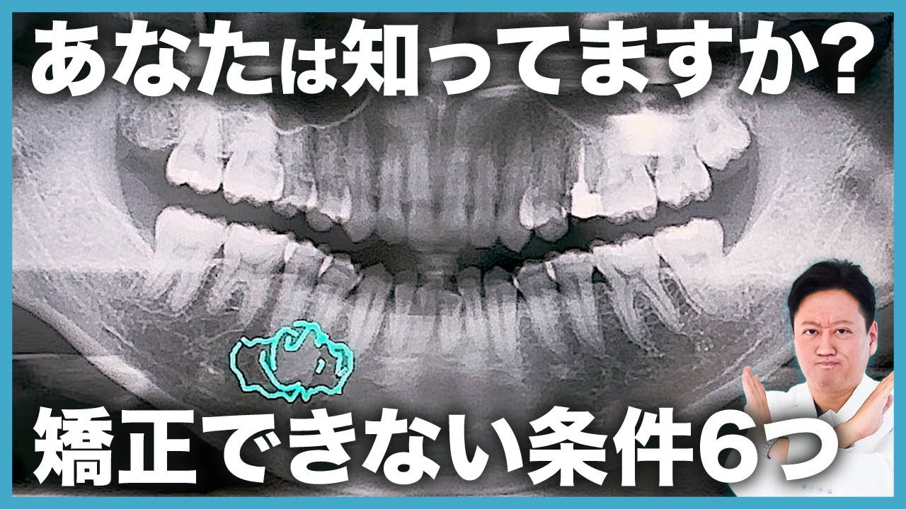 矯正する前に見て！〇〇な人は歯列矯正が難しいかもしれません…【審美歯科 歯並び 虫歯】