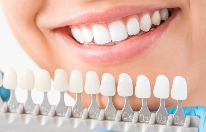 ホワイトニングは歯医者がいい？歯科医院とサロンの違いを徹底比較！
