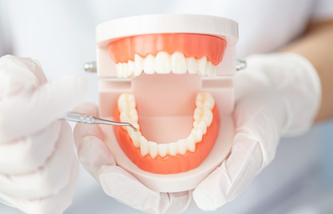 銀歯をセラミックに変えられる？歯の詰め物のポイントと注意点